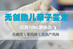 杭州怀孕亲子鉴定预约,杭州孕期亲子鉴定机构去哪查找 杭州怀孕亲子鉴定预约,杭州孕期亲子鉴定机构去哪查找