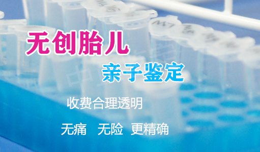 杭州怀孕亲子鉴定如何做,杭州产前亲子鉴定中心预约办理 杭州怀孕亲子鉴定如何做,杭州产前亲子鉴定中心预约办理